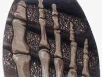 Treads Align with Metatarsal Bones